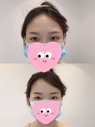 -MIVI半永久纹眉绣眉