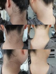 -薇兰专业脱毛连锁机构