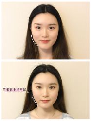 -FACE·日本小颜矫正美容整骨サロン