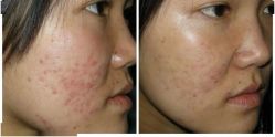 -SKINIST丽铂医疗美容