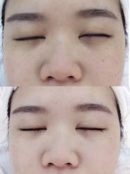 点击看大图 -SKIN79皮肤管理中心