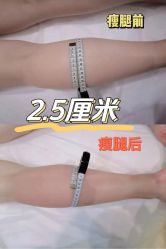 点击看大图 -Lily纤美·科技减脂中心