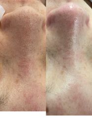 -SKIN79皮肤管理中心