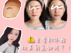 -FACE·日本小颜美容整骨(福田店)