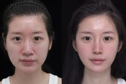 点击看大图 -Yestar艺星医疗美容医院