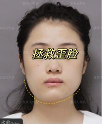 -圣嘉新医疗美容医院