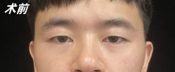 -素美医疗美容·西南眼鼻整形·修复基地