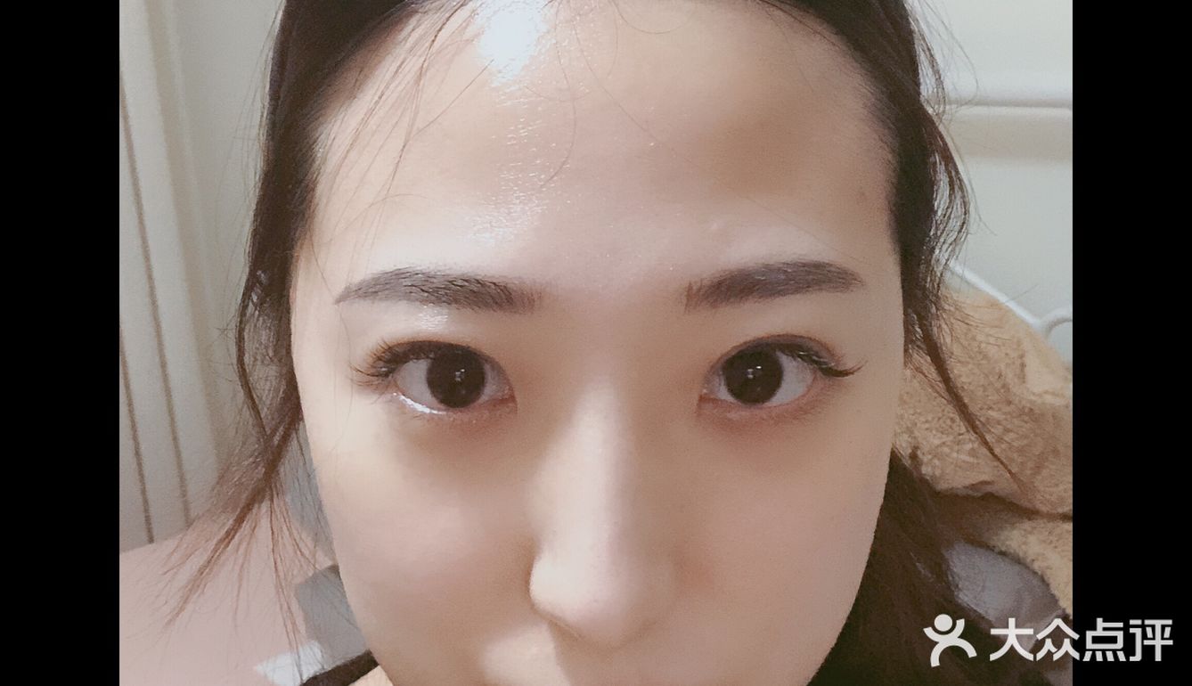 1月29日打了第二针菁芙水光针，目的是保湿
