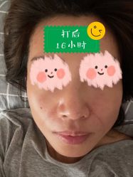 -新美荟医美·专注面部美学抗衰