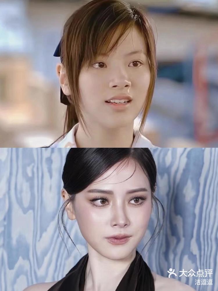 总结一下泰国小水做过的医美惊艳版