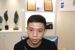 -大麦微针植发丨全国连锁