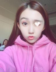 点击看大图 -广州健丽·去眼袋医疗美容机构