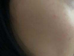 -广州美莱医疗美容医院