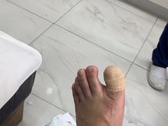 -Andrew指甲专科灰指甲·甲沟炎矫正·3D步态矫形鞋垫定制(浦三路店)