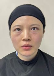 -广州健丽·去眼袋医疗美容机构
