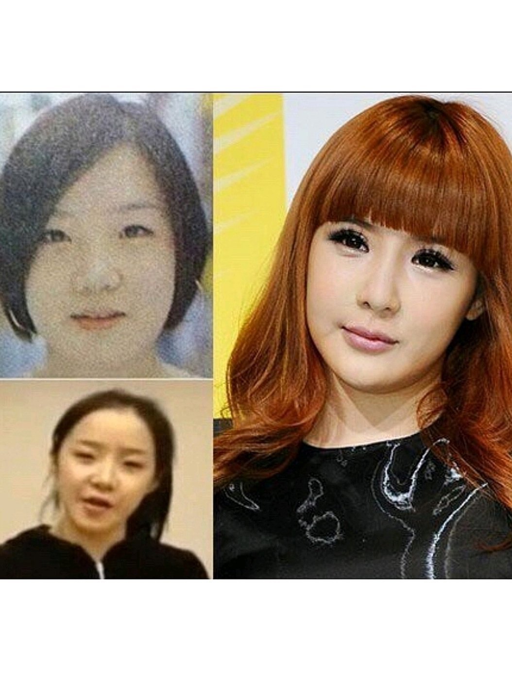 朴春的脸是怎么了?