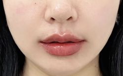 -天津健丽·去眼袋医疗美容机构