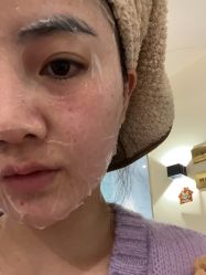 -柠檬一美·Ondapro·轻薄紧致抗衰中心
