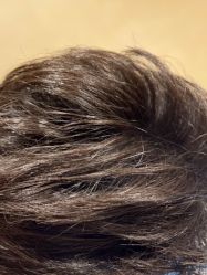 -熙朵美学植发·连锁品牌