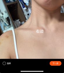 体验前-深圳米兰柏羽医疗美容医院