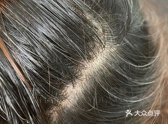 #养发效果反馈# 【护理项目】古法白发转黑