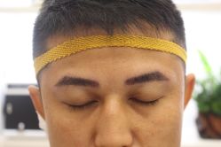 -大麦微针植发丨全国连锁