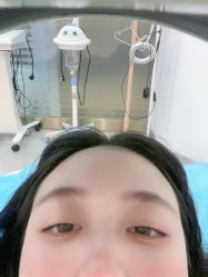 -新雨池不针清祛痘