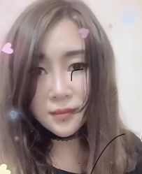 体验前-Yestar 嘉兴艺星医疗美容医院