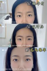 点击看大图 -久匠·纹眉纹绣半永久