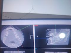 -土豆口腔(凤凰北总店)