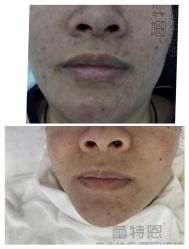 -蕾特恩专业祛痘·皮肤管理