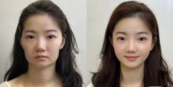 -Yestar 嘉兴艺星医疗美容医院