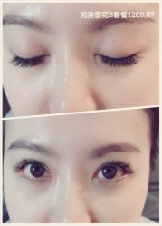 睫毛嫁接-光SPA科技美肤