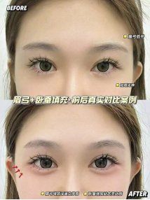 -南京美莱医疗美容·旗舰店