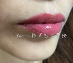 点击看大图 -YooMee优美智能科技美肤机构