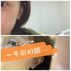 -苗方清颜·祛痘皮肤管理