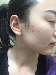 -皇族养心堂·净痘·修敏·御颜
