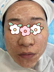 体验前-联合丽格·张菡丽格医疗美容