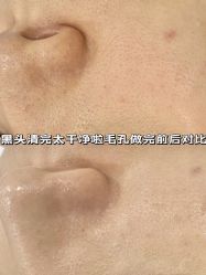 -凡碧诗毛孔清洁收细
