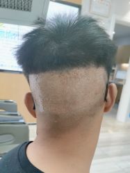 -雍禾植发全国连锁