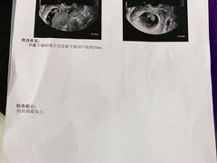 -伊丽莎白妇科医院·早孕检查