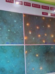 点击看大图 -凡碧诗毛孔清洁收细