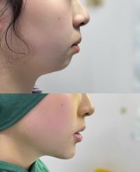 -郡艺医疗美容·微整·眼鼻吸脂