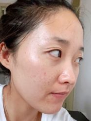 体验前-东剑医学美容·注射美学中心