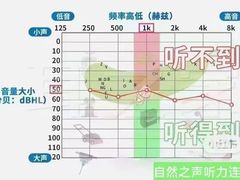 -自然之声助听器·呼吸机(和平店)