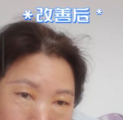 -八大处整形
