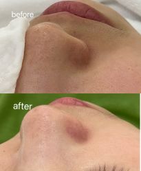 -skin79皮肤管理中心