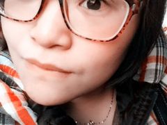 现在最后的效果，我恢复超级快-上海华安整形外科门诊部