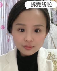 -素美医疗美容·西南眼鼻整形·修复基地