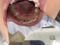 -宁波壹加壹口腔·矫正种植中心